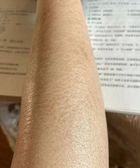 腿好干啊,看起来像长了鱼鳞一样,怎样能去掉?