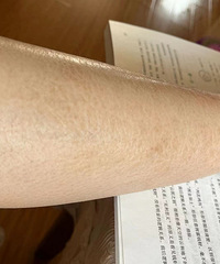 救命!我的腿好干啊,看起来像长了鱼鳞一样,怎样能去掉?