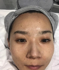 千万不要打水光针,不然会爱住!我上妆终于服帖了