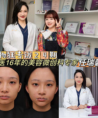 如何正确有效追求幼态感?这个方法能够重塑面部轮廓,轻松变年轻