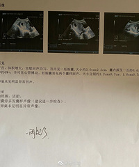 ����ȥ��鱦����û��̥�ģ��������֪����������̥