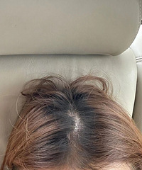 �����²�Ⱦһ�η����᲻���°����ò�Ⱦһ�αȽϺ��ʰ�