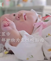 ������췢�ֺ��������⣬���������