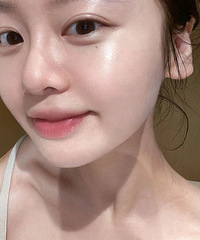 做完水光后要怎么护理?纯干货分享!赶紧看过来吧