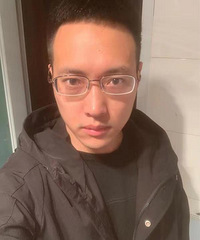 想了很多年,终于做了近视手术!这个医院的服务和技术,都很满意