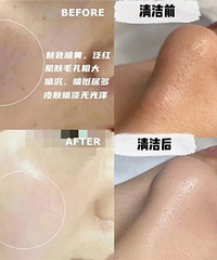 适合夏天的变美项目盘点,一起来看!