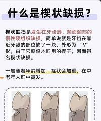 第一次根管治疗流程及费用(上清寺口腔医院)
