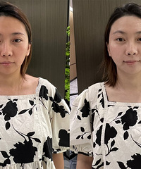 这个高科技美白舱真的震惊我了!30分钟就变白3个度,不信看图