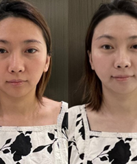 美白舱30分钟,我白了3个度