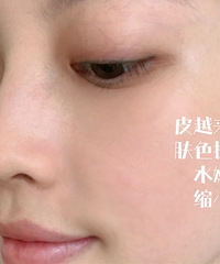 水光针初体验 ,皮肤亮了几个度!化妆都不卡粉了