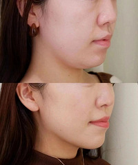 �������ˣ�������һ�º��°�ͻȻ�����ˣ����е㲻ϰ��