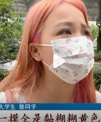 大学生染发后患皮炎头上直流脓水