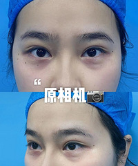 30�꿹˥�����飬ֻ���˼����Ӻ���Ȧû�ˣ�����Ч���ú�