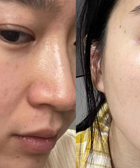 成本最低的变美方式,坚持早睡2个月的对比,皮肤真的越来越好