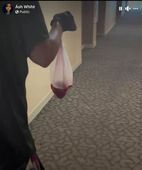 �Ƶ귿�䷢��һ����ɫҺ�壬������Ա�������ǡ�����̥����