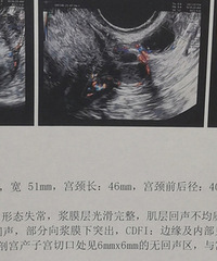 �е�����ˣ������ӹ����Ҳ���ͣ��������Ĥ����