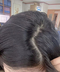 救命!年纪轻轻就长了好多白头发,有没有同样情况的姐妹?