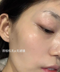 定期打水光针一年的皮肤状态,我再也不会买贵价护肤品了