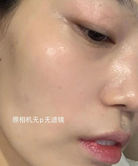 定期水光针一年的皮肤状态,不会再买贵价护肤品了