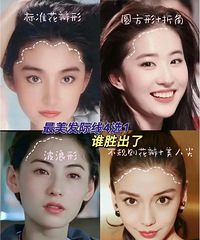 有发际线丑的爆的姐妹吗?想去植发了