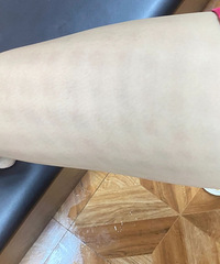 去漂流记得别穿格子裤啊!我连夜给大腿敷面膜
