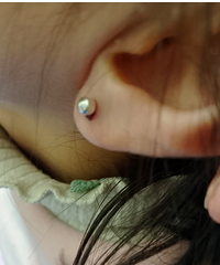 ��Ӥ���������4��Ů�������״��ű�¶���ҳ�Ϊ��ƴ�������ӣ�