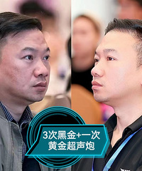 作为一个男医生,我也做了黄金超声炮,来说说为什么