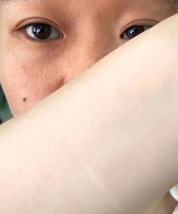 身体是那种粉白皮,可是脸是黄黑皮,求问如何变白!