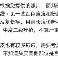 ֬Ƥ+�+ͷƤ�����Ľ��ý�����Ǯѯ���˶���ҽ���õ����·���