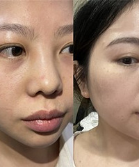 这是我觉得真能缩毛孔的好方法