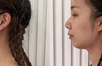 肉肉脸的救星来了!下颌线变得好清晰啊