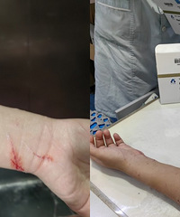 被自己家猫抓了,花了3000打针