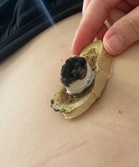 �����Ķ����ۺ�ʪ����ʲôԭ������λ������Ը�������