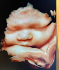 �и������ޣ����˼䶼ס���ˣ�������ֻ��˯������