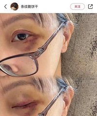 ���Ǳ������˹���ȥҽԺ���ػ���Ҫ��Ҫ��æ������