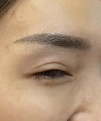 30+之后,真的好多皱纹!鱼尾纹和抬头纹太丑了