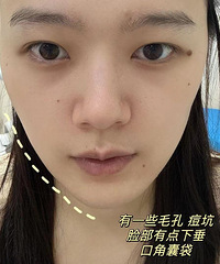 30岁没忍住!还是做了Fotone4D pro