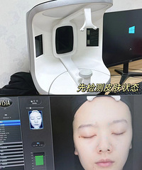 30岁没忍住!还是做了Fotone4D pro