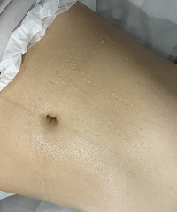 这个祛湿的好方法,一次排掉我全身一周的汗!关键对减肥还特有效