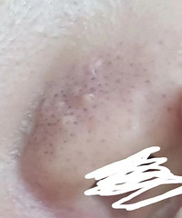 �����Ϻ�ͷ�ܶ໹�кü�����ɫ�Ķ����������������