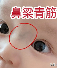 10娃9个脾胃虚,如何帮助孩子健脾?分享几个简单推拿方法!