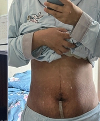 ����ǰ�������Ա�ͼ��Ƥ�����Ⱳ�Ӷ��ز�ȥ��