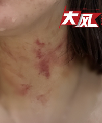 牵狗乘电梯引冲突,女子遭推搡致身体裸露……