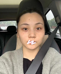 超皮秒祛斑,今年性价比最高的变美项目了