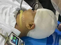 学生被老师打碎头骨
