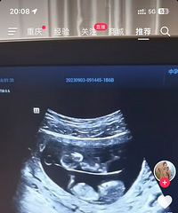 ����й�̥�����ε���ʲô�أ�