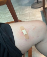 ���˿�����Ĺ���������ҧ�ˣ�ƽ����ͦ��˳��