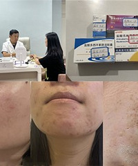 这样去找皮肤科专家看病,真的好轻松