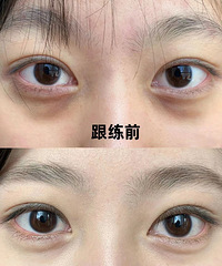 ��ְ˶ν�+�۲��٤+��˯��3���º�Աȣ�����Ȧ���������ԣ�