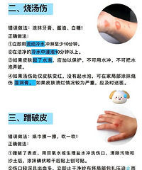 宝宝急救方法分享